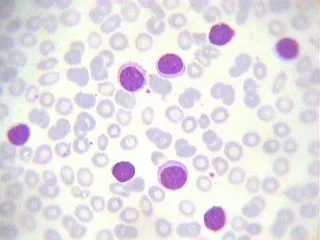 Blood cells image