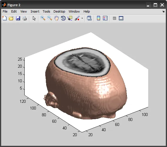 isosurface_isocaps