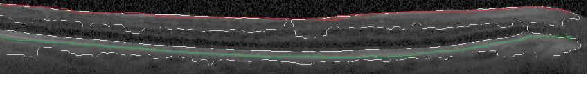 red line:top border of first layer, green line: brightest line in the 2nd layer